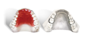 upper and lower orthodontic retainer