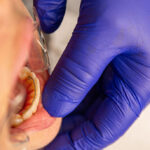 Why Straight Teeth Don’t Stay Straight — And What We Do Differently